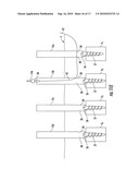 Method And Apparatus For Facilitating Navigation Of An Implant diagram and image