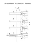 Method And Apparatus For Facilitating Navigation Of An Implant diagram and image