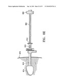 DEVICE AND METHOD FOR SAFE LOCATION AND MARKING OF A BIOPSY CAVITY diagram and image