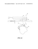 ULTRASOUND GUIDED HIGH INTENSITY FOCUSED ULTRASOUND TREATMENT OF NERVES diagram and image