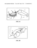 ULTRASOUND GUIDED HIGH INTENSITY FOCUSED ULTRASOUND TREATMENT OF NERVES diagram and image