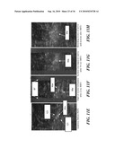 ULTRASOUND GUIDED HIGH INTENSITY FOCUSED ULTRASOUND TREATMENT OF NERVES diagram and image