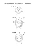 CANNULA EQUIPPED WITH A PROTECTIVE HOUSING diagram and image