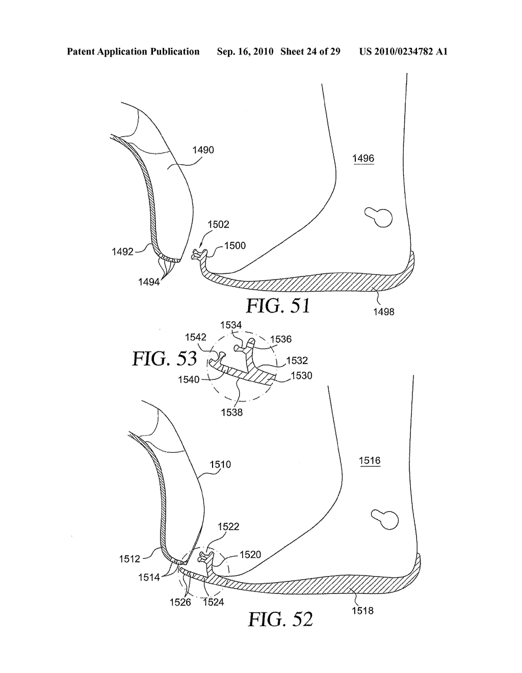 CIRCUMFERENTIAL WALKER - diagram, schematic, and image 25