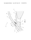 OCULAR IMPLANT WITH THERAPEUTIC AGENTS AND METHODS THEREOF diagram and image