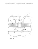 OCULAR IMPLANT WITH THERAPEUTIC AGENTS AND METHODS THEREOF diagram and image