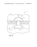 OCULAR IMPLANT WITH THERAPEUTIC AGENTS AND METHODS THEREOF diagram and image