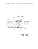 OCULAR IMPLANT WITH THERAPEUTIC AGENTS AND METHODS THEREOF diagram and image