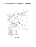 OCULAR IMPLANT WITH THERAPEUTIC AGENTS AND METHODS THEREOF diagram and image