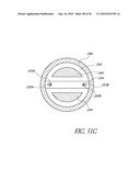 OCULAR IMPLANT WITH THERAPEUTIC AGENTS AND METHODS THEREOF diagram and image