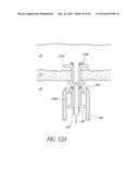 OCULAR IMPLANT WITH THERAPEUTIC AGENTS AND METHODS THEREOF diagram and image