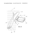 OCULAR IMPLANT WITH THERAPEUTIC AGENTS AND METHODS THEREOF diagram and image