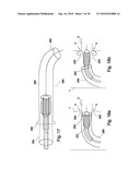 VESSEL TREATMENT DEVICES diagram and image