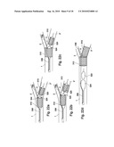 VESSEL TREATMENT DEVICES diagram and image