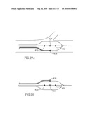 VESSEL TREATMENT DEVICES diagram and image