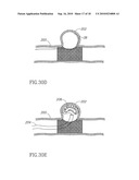 VESSEL TREATMENT DEVICES diagram and image