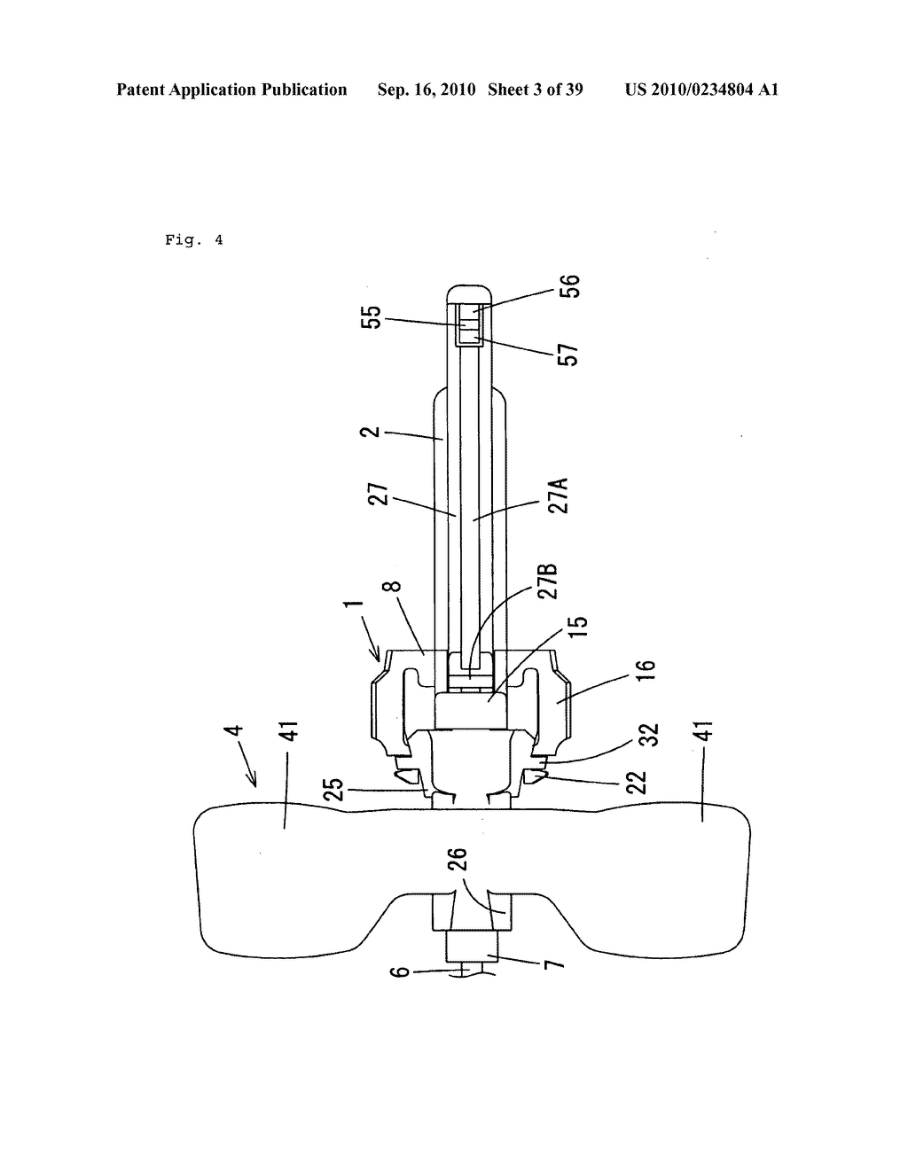 Indwelling Needle with wings - diagram, schematic, and image 04