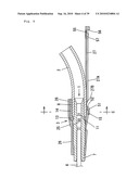 Indwelling Needle with wings diagram and image