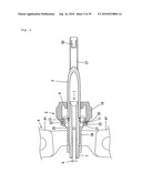 Indwelling Needle with wings diagram and image