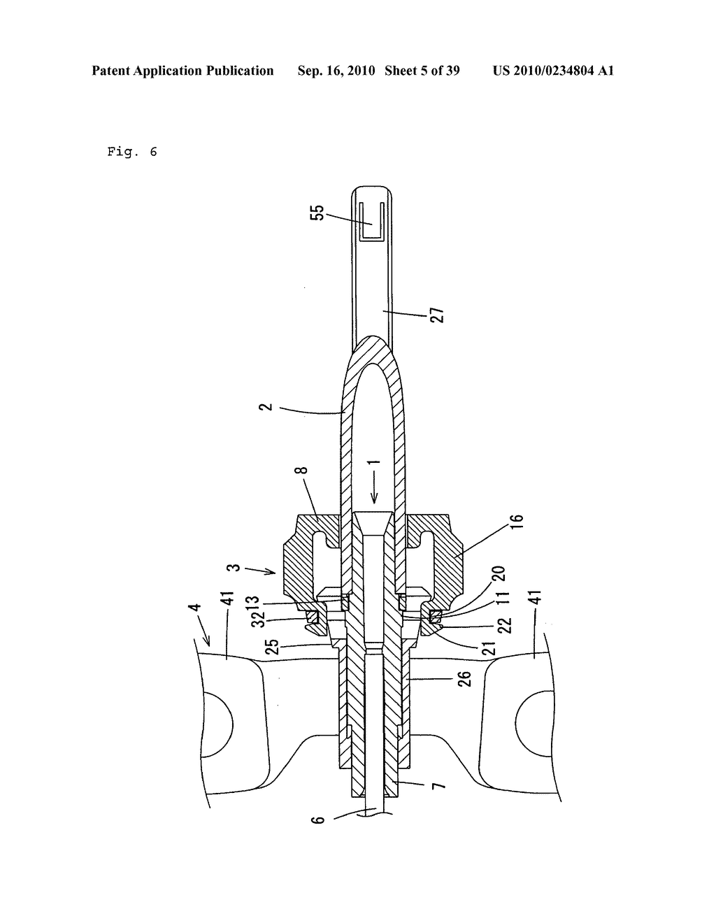 Indwelling Needle with wings - diagram, schematic, and image 06