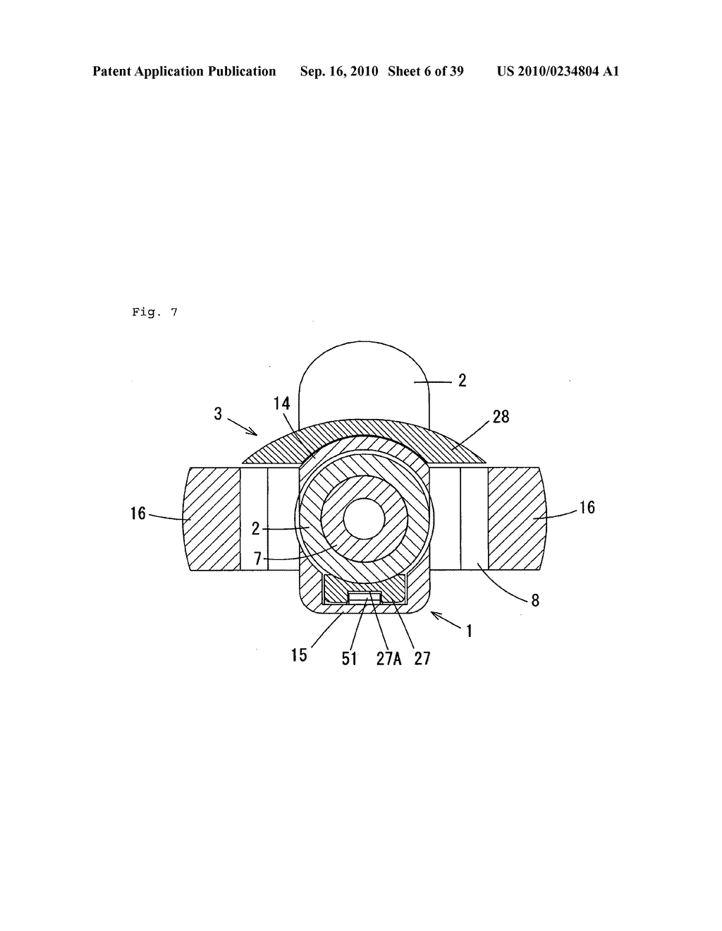 Indwelling Needle with wings - diagram, schematic, and image 07