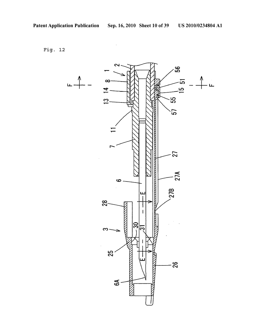 Indwelling Needle with wings - diagram, schematic, and image 11