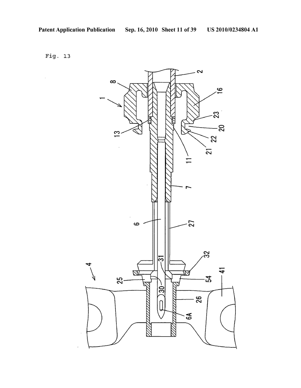 Indwelling Needle with wings - diagram, schematic, and image 12