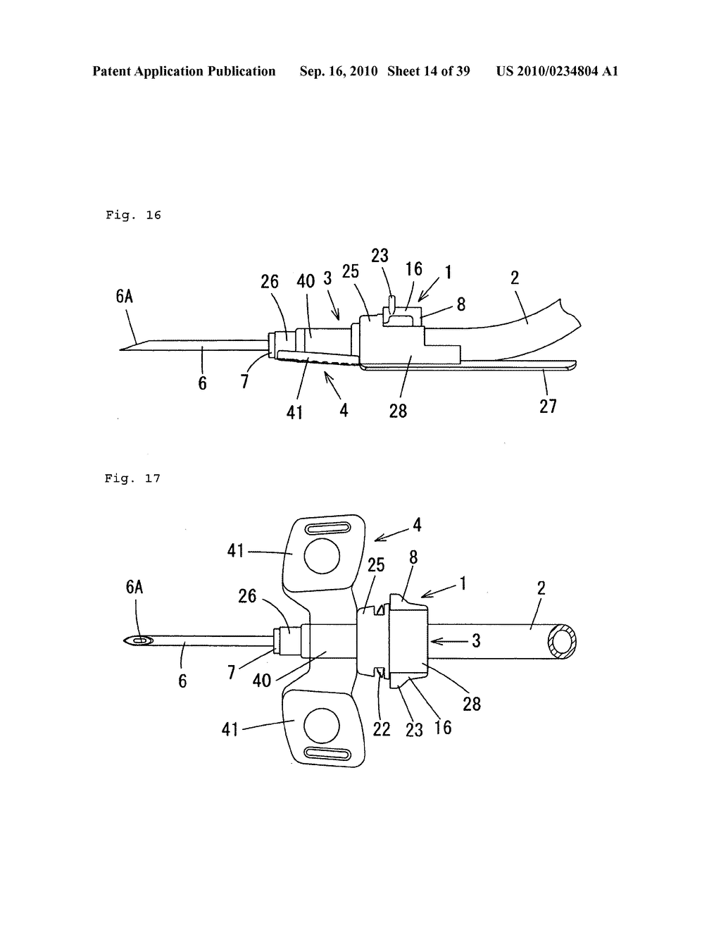 Indwelling Needle with wings - diagram, schematic, and image 15