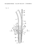 Indwelling Needle with wings diagram and image