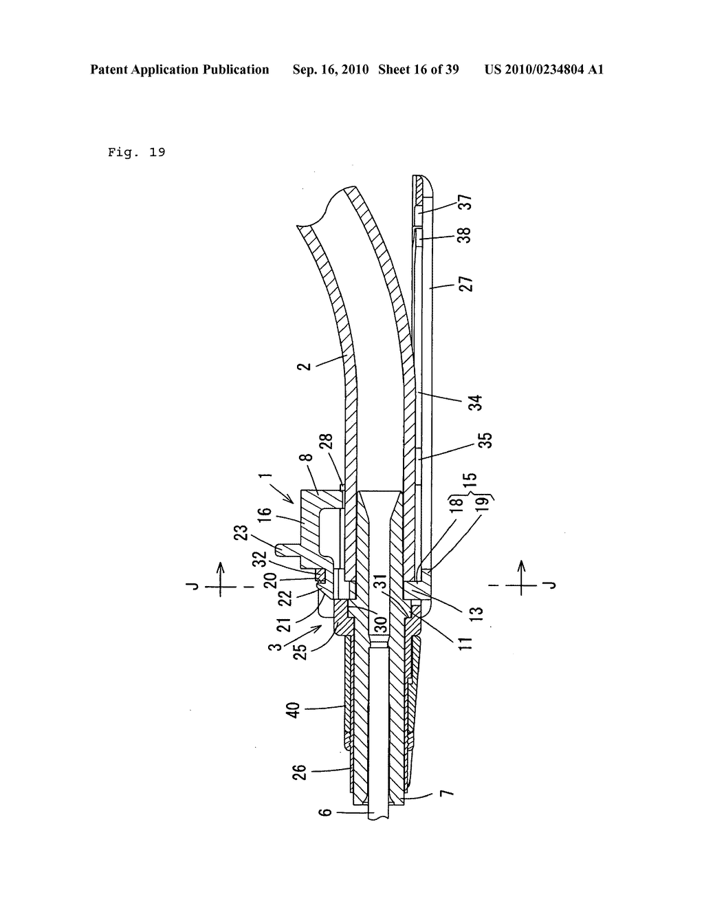 Indwelling Needle with wings - diagram, schematic, and image 17