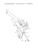 Indwelling Needle with wings diagram and image