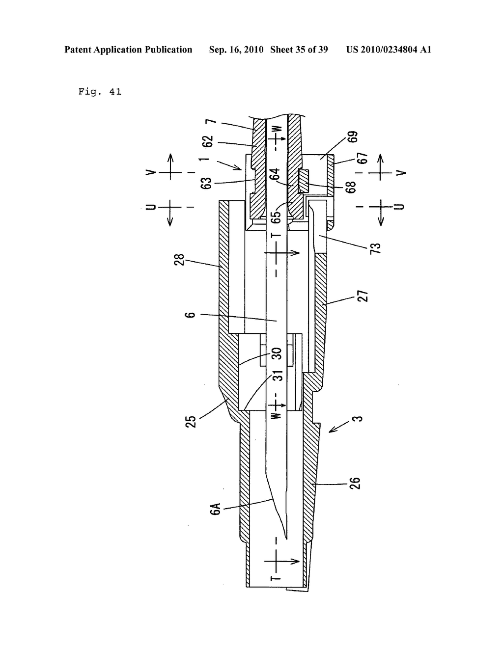 Indwelling Needle with wings - diagram, schematic, and image 36