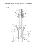 Indwelling Needle with wings diagram and image