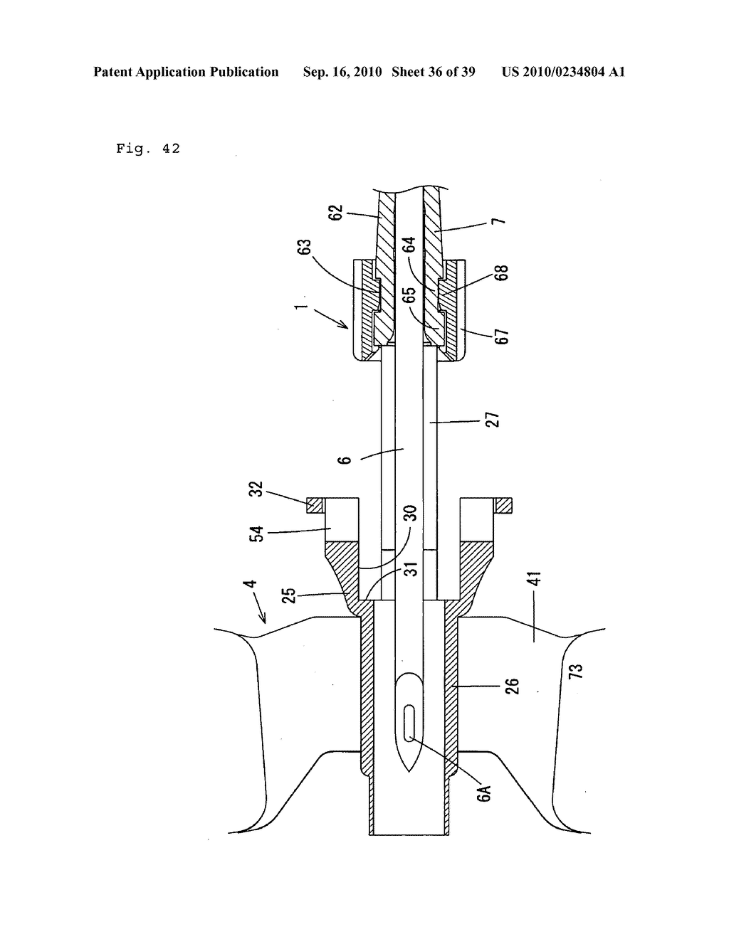 Indwelling Needle with wings - diagram, schematic, and image 37