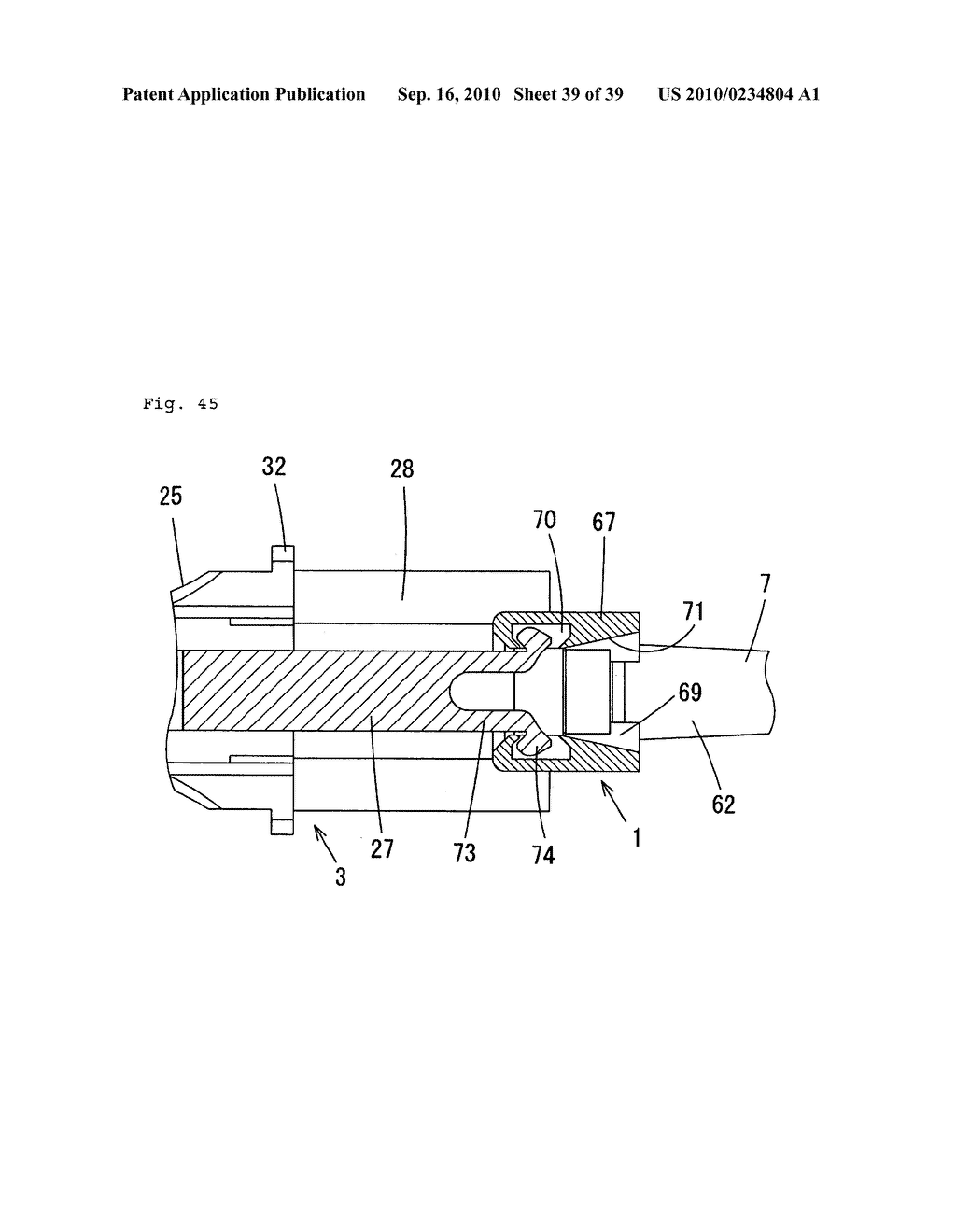 Indwelling Needle with wings - diagram, schematic, and image 40