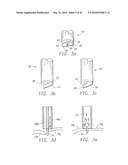 MINIMALLY INVASIVE MITRAL VALVE REPAIR METHOD AND APPARATUS diagram and image