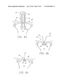 MINIMALLY INVASIVE MITRAL VALVE REPAIR METHOD AND APPARATUS diagram and image