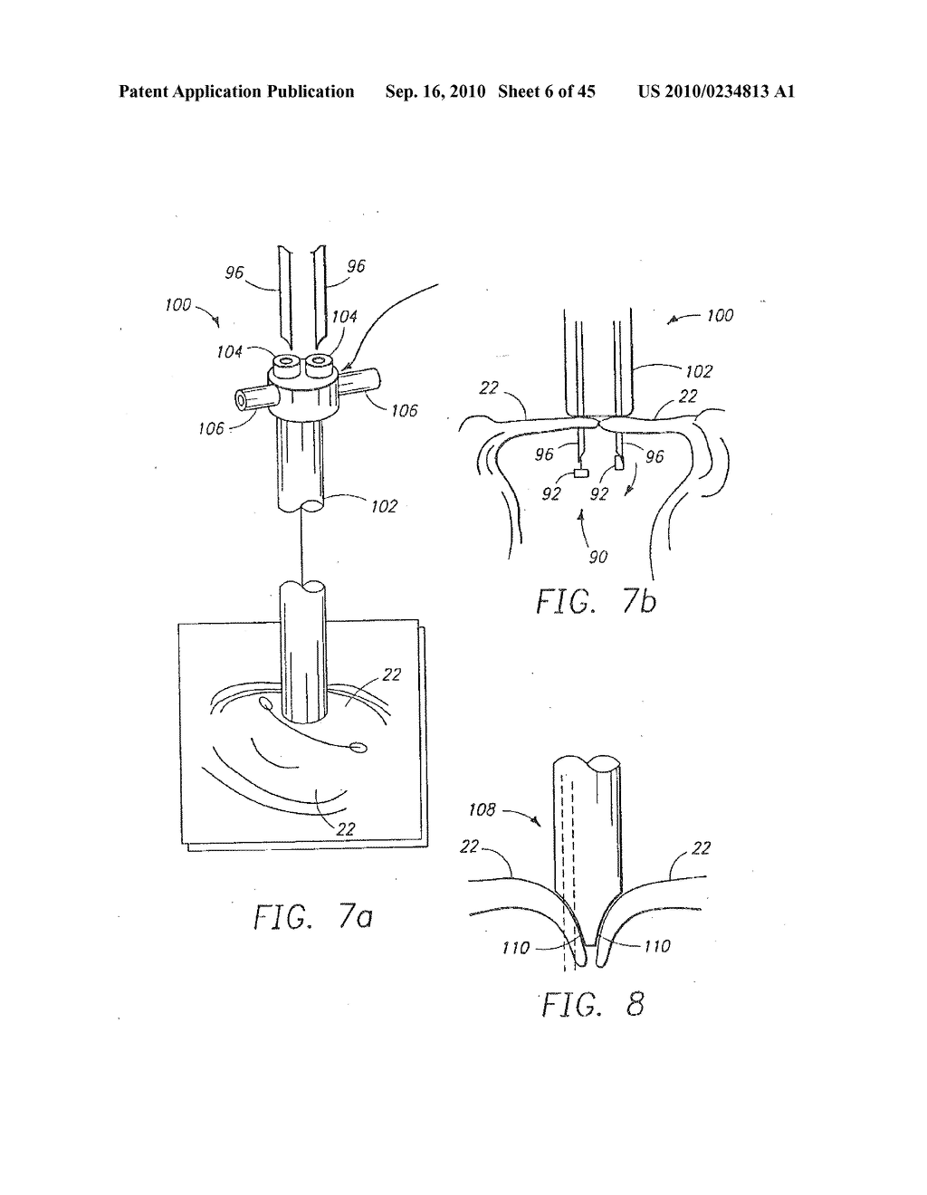 MINIMALLY INVASIVE MITRAL VALVE REPAIR METHOD AND APPARATUS - diagram, schematic, and image 07