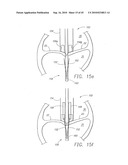 MINIMALLY INVASIVE MITRAL VALVE REPAIR METHOD AND APPARATUS diagram and image