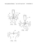 MINIMALLY INVASIVE MITRAL VALVE REPAIR METHOD AND APPARATUS diagram and image