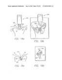 MINIMALLY INVASIVE MITRAL VALVE REPAIR METHOD AND APPARATUS diagram and image