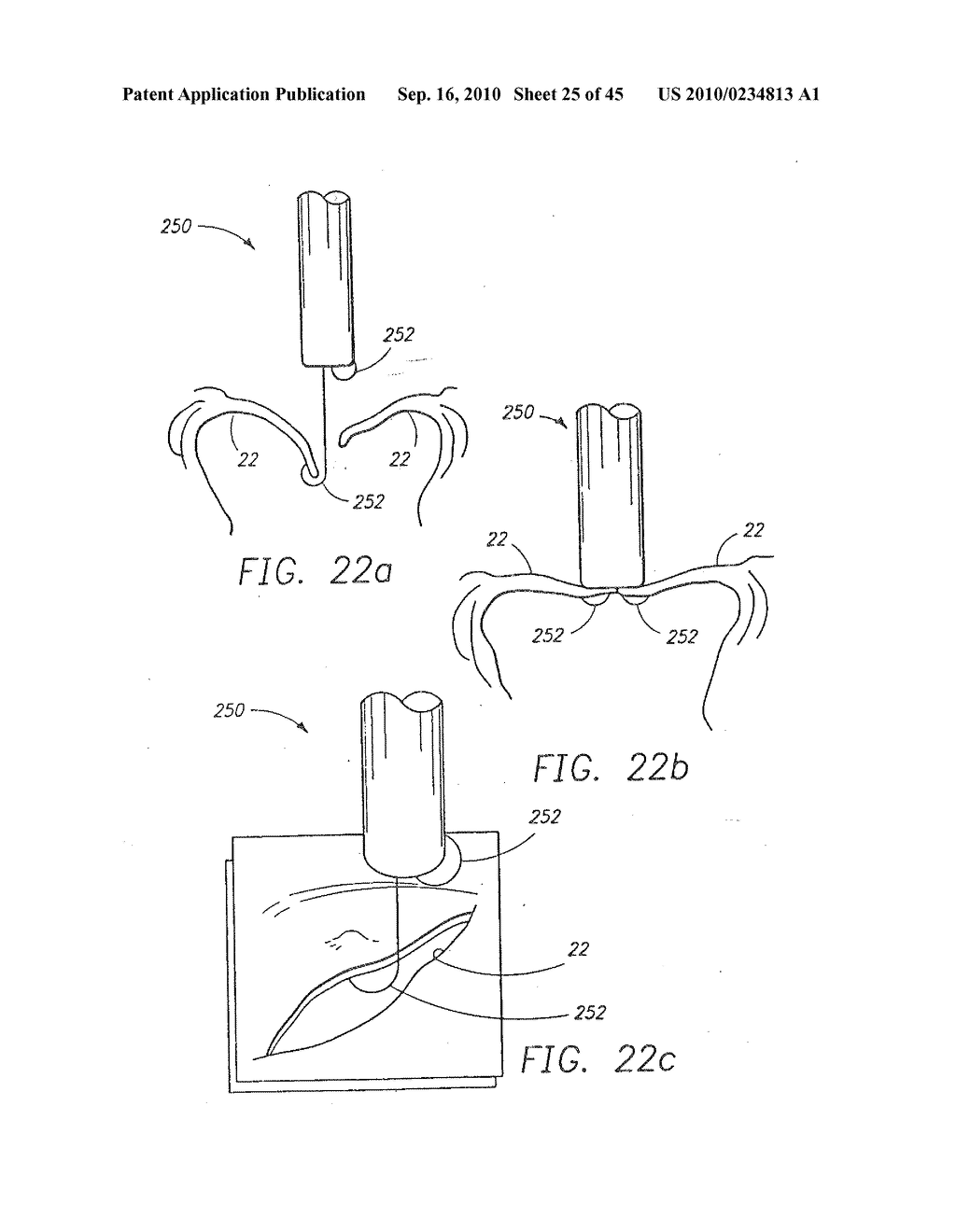 MINIMALLY INVASIVE MITRAL VALVE REPAIR METHOD AND APPARATUS - diagram, schematic, and image 26