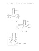 MINIMALLY INVASIVE MITRAL VALVE REPAIR METHOD AND APPARATUS diagram and image