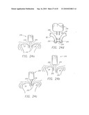 MINIMALLY INVASIVE MITRAL VALVE REPAIR METHOD AND APPARATUS diagram and image