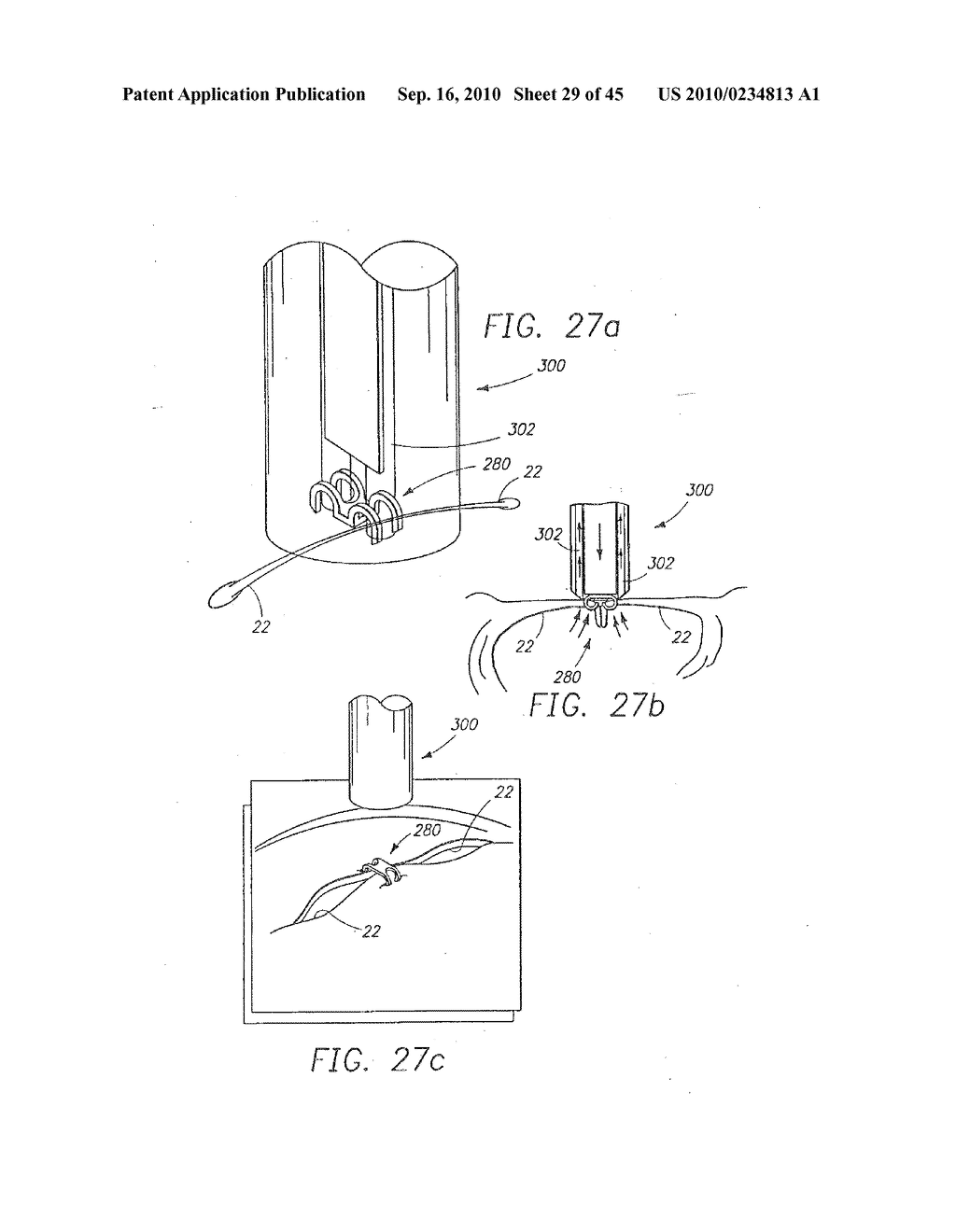 MINIMALLY INVASIVE MITRAL VALVE REPAIR METHOD AND APPARATUS - diagram, schematic, and image 30