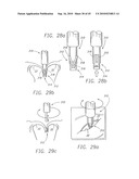 MINIMALLY INVASIVE MITRAL VALVE REPAIR METHOD AND APPARATUS diagram and image