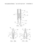 MINIMALLY INVASIVE MITRAL VALVE REPAIR METHOD AND APPARATUS diagram and image