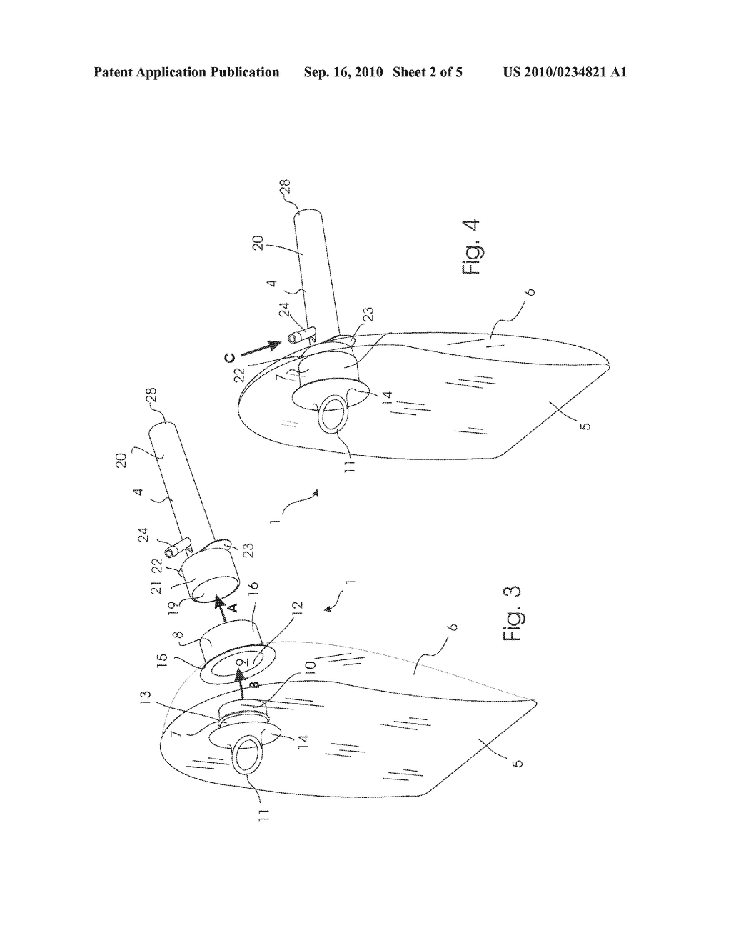 INTESTINAL IRRIGATION DEVICE AND METHOD OF USING THE DEVICE - diagram, schematic, and image 03