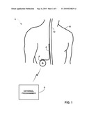 RELEASING A MATERIAL WITHIN A MEDICAL DEVICE VIA AN OPTICAL FEEDTHROUGH diagram and image