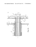 SYSTEM AND METHOD FOR CATHETER-BASED SEPTAL DEFECT REPAIR diagram and image